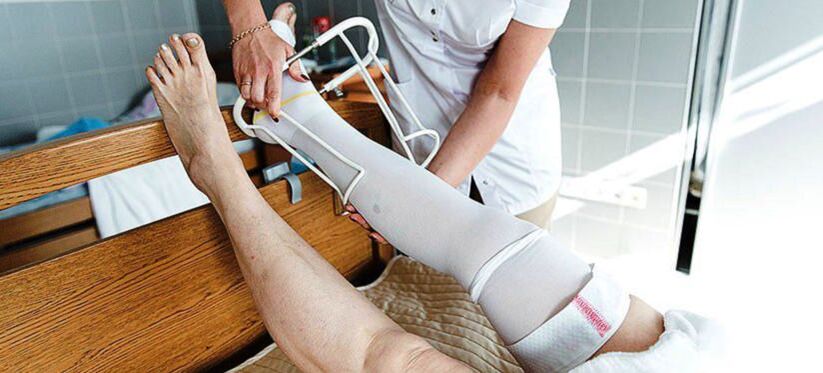 Kompressionsstrümpfe zur Behandlung von Krampfadern